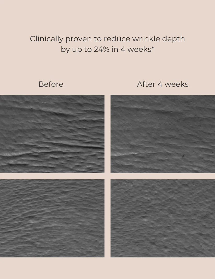 Ser cu Bakuchiol - Alternativă Naturală la Retinol