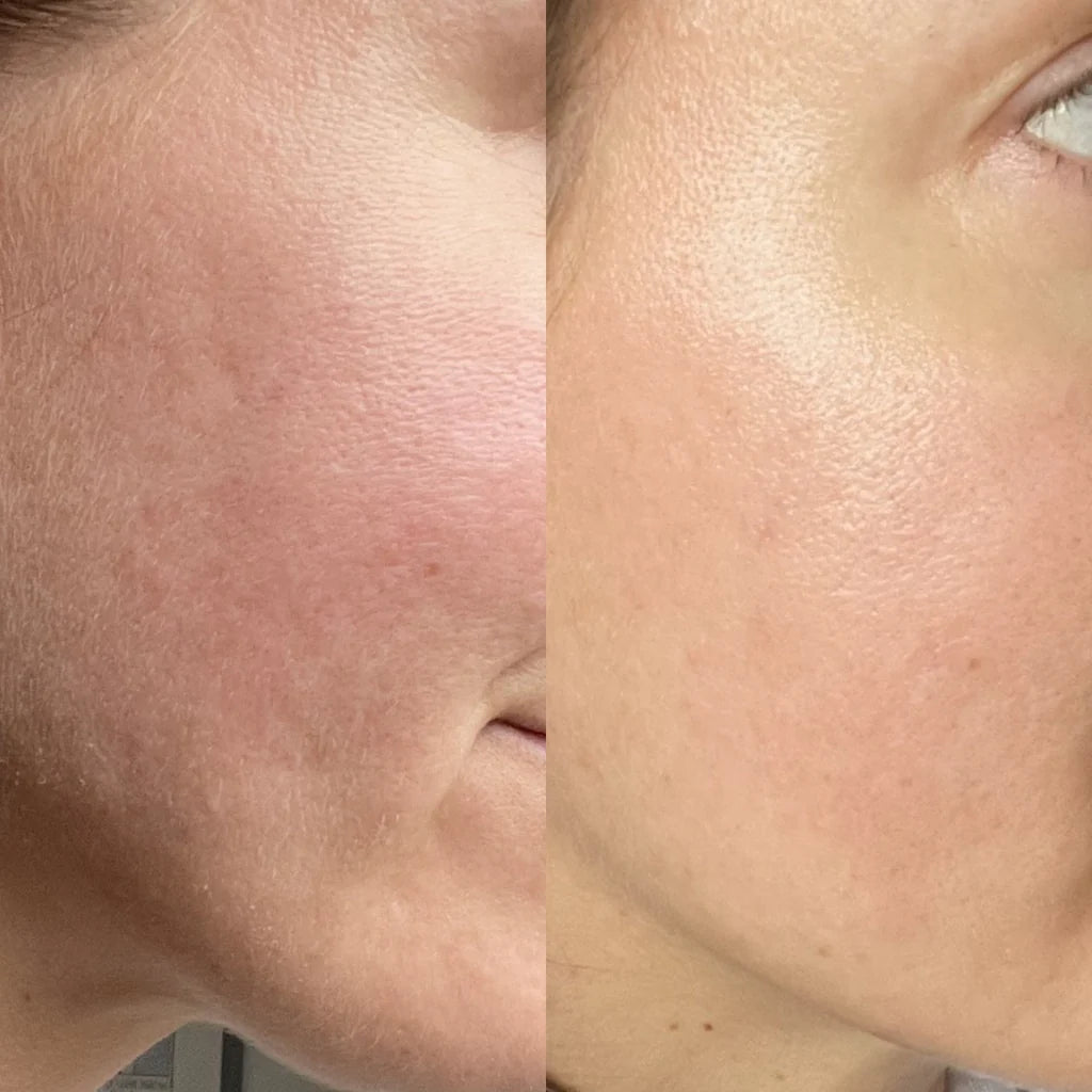 The Glow Serum
