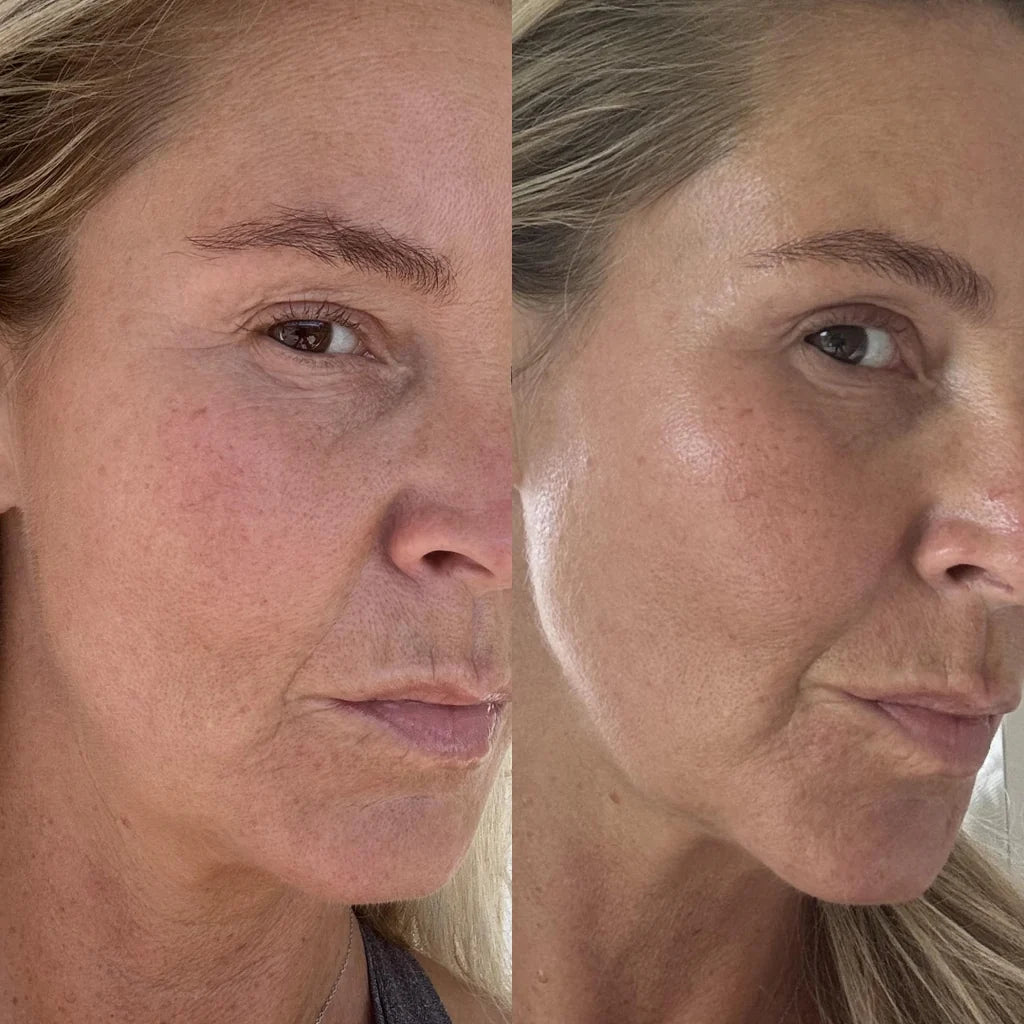 The Hydra Serum