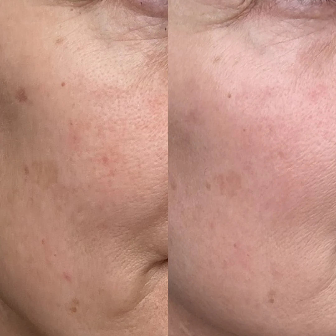 The Longevity Cream