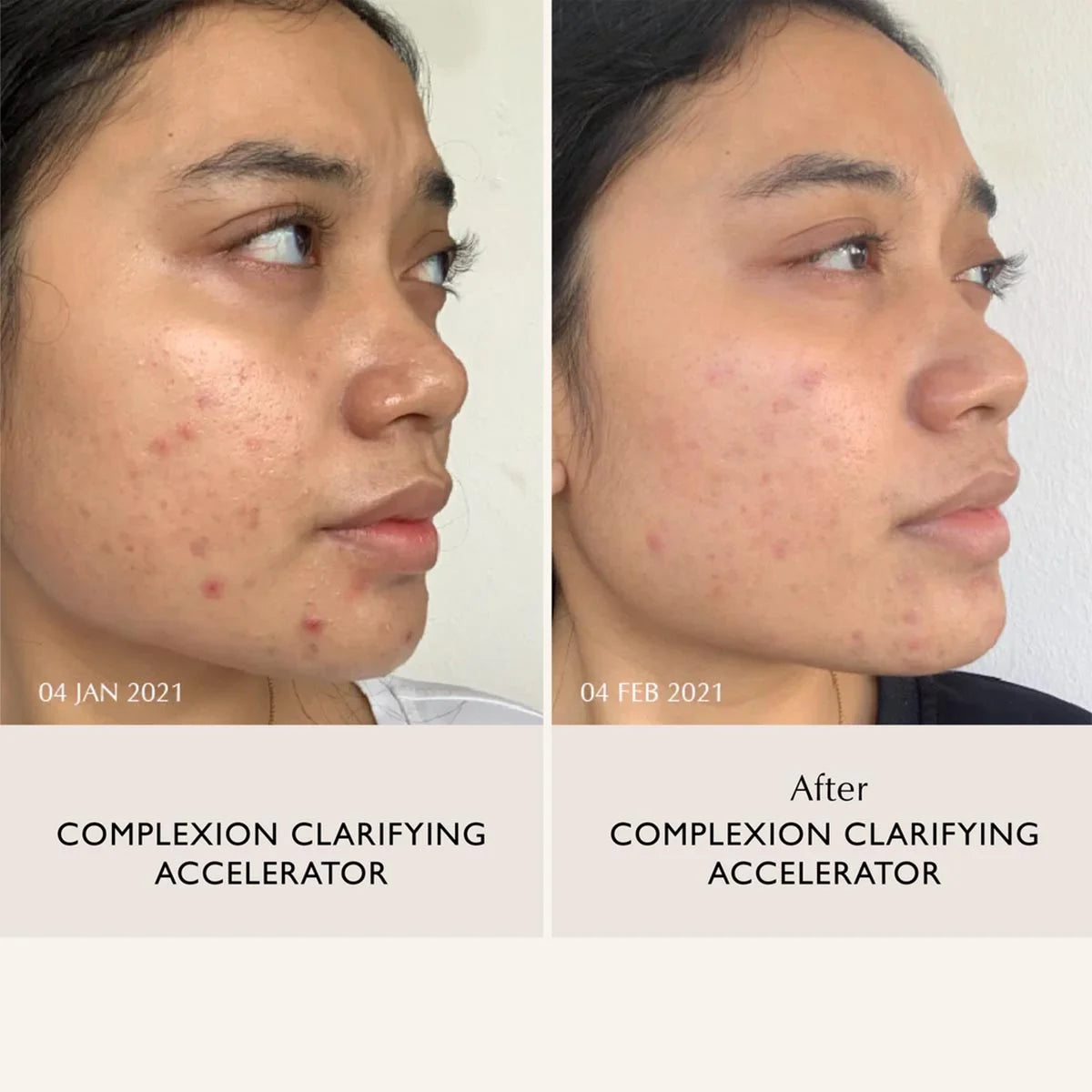 Complexion Clarifying Accelerator - Dioic & Mandelic Complex