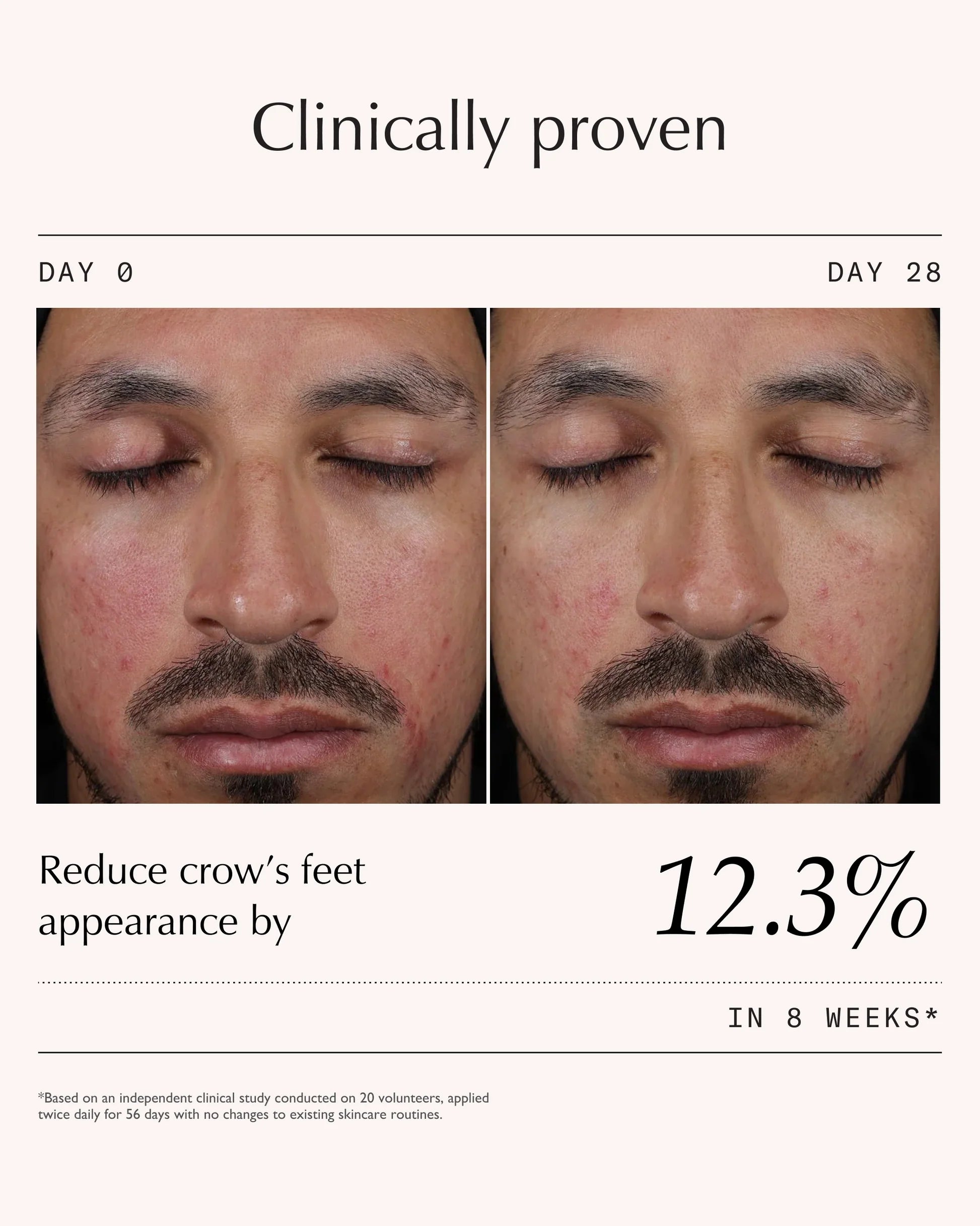 Peptide Pro Resilience® Serum Concentrate