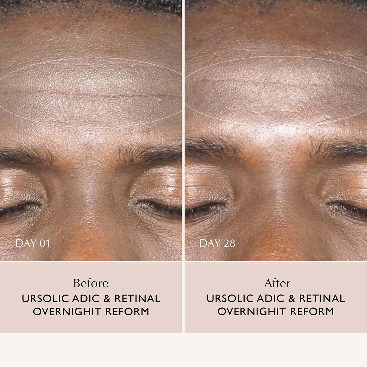 Ursolic Acid & Retinal Overnight Reform